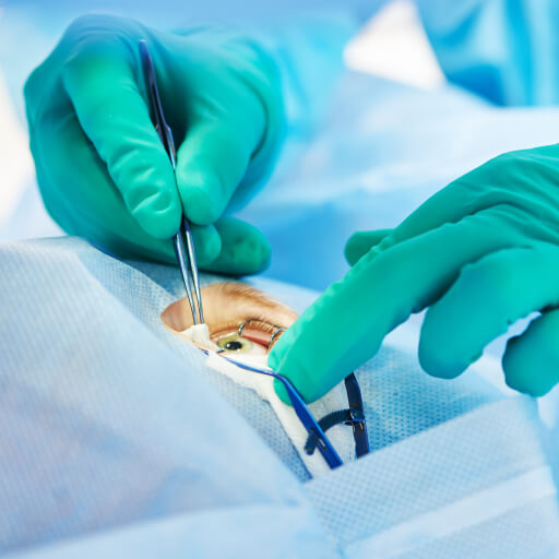 どの二重施術が自分に合っているか分からない